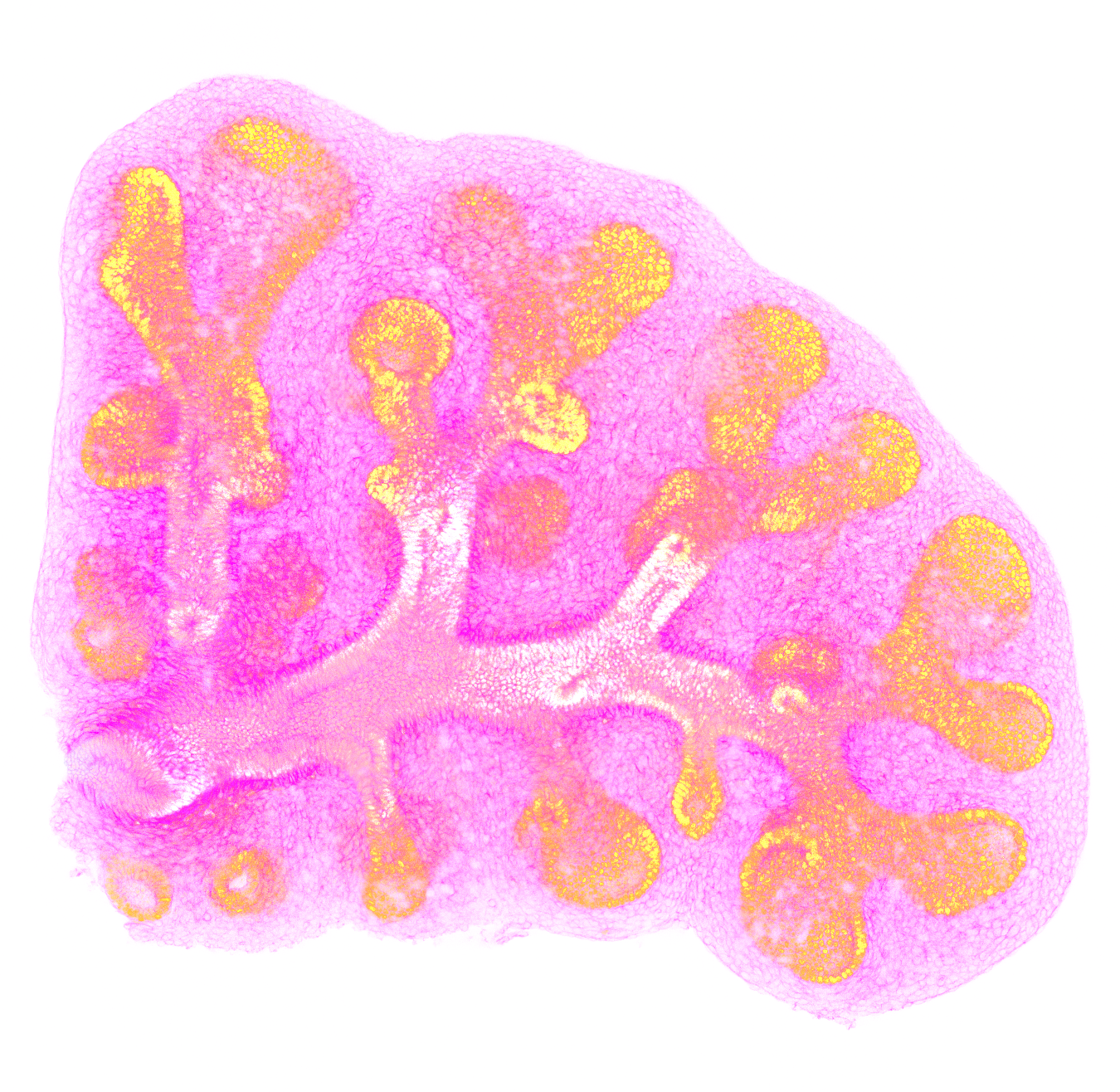 Fluorescence image of a branching lung explant